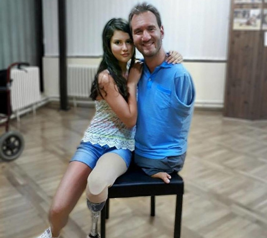 PRIČA KOJA INSPIRIŠE zbog karcinoma Biljani (13) amputirana noga, ona danas trči i jaše i pomaže drugoj bolesnoj djeci