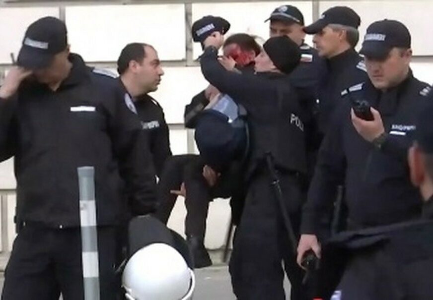 KRVAVI PIR HULIGANA Policajka zamalo ostala bez oka na stadionu poslije EKSPLOZIJE bombe (VIDEO)