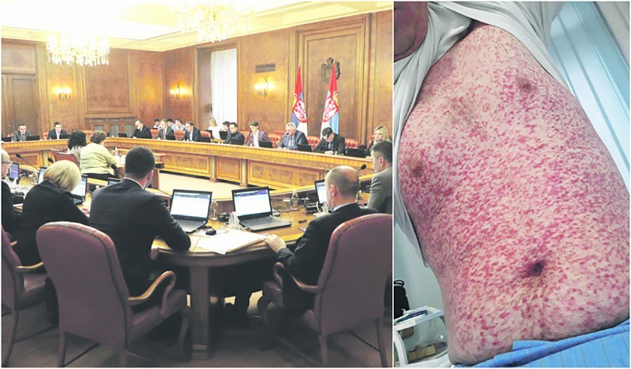 VIRUS MORBILA STIGAO U VLADU SRBIJE Ministri strahuju od zaraze, svi zaposleni moraju HITNO da se testiraju