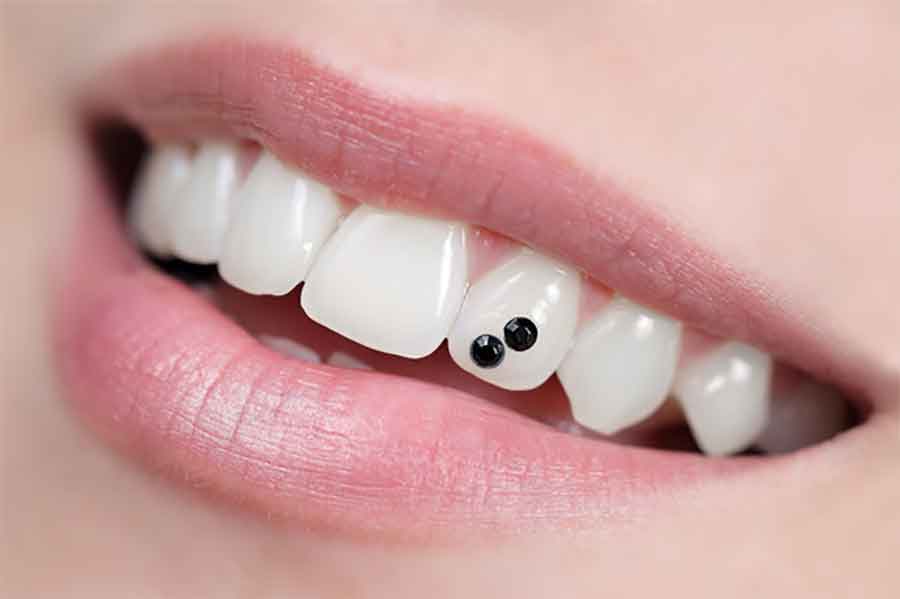OBRATITE PAŽNJU Ove navike mogu da oštete vaše zube
