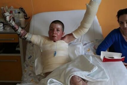 MEDICINSKI FENOMEN Dječaku sa teškim opekotinama davali JEDAN ODSTO ŠANSE da će preživjeti, nakon deset operacija stao na noge