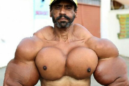 BRAZILSKI HULK ŠOKIRAO SVIJET Ubrizgava ulje u bicepse, izgleda kao čudovište i NEMA NAMJERU DA SE ZAUSTAVI
