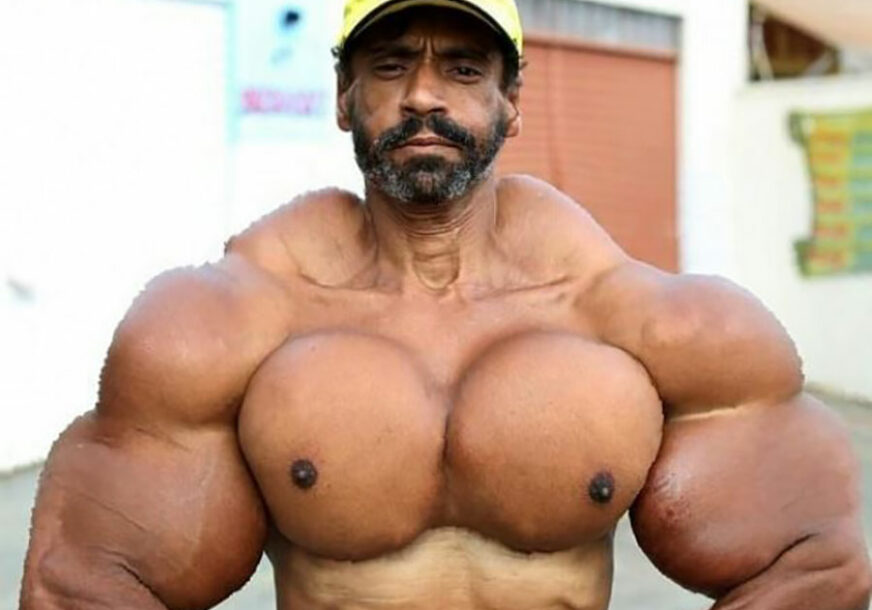 BRAZILSKI HULK ŠOKIRAO SVIJET Ubrizgava ulje u bicepse, izgleda kao čudovište i NEMA NAMJERU DA SE ZAUSTAVI