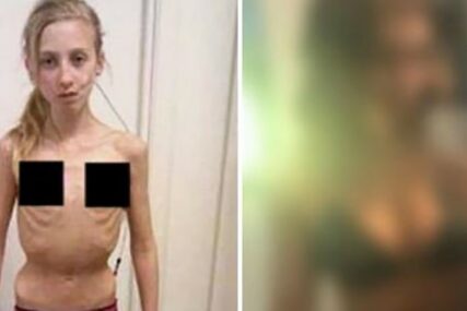 Živjela je samo na ŽVAKAMA i KISELOJ VODI i imala 32 kilograma, a evo kako danas izgleda