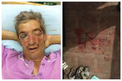 POLICIJA TRAGA ZA NAPADAČIMA Šipkama brutalno pretukli bivšeg borca Vojske RS u porodičnoj kući