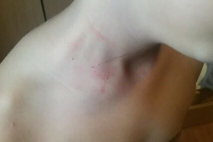 "MAMA, MORAM LI DANAS U ŠKOLU?" Ispovijest majke osnovca kojeg je DAVIO VRŠNJAK na malom odmoru