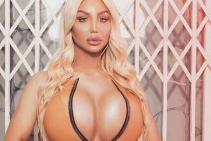 ŽELI DA IZGLEDA KAO LUTKA ZA SEKS Ivana je bila na 20 estetskih operacija, a planira još najmanje četiri (FOTO)