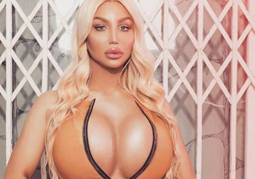 ŽELI DA IZGLEDA KAO LUTKA ZA SEKS Ivana je bila na 20 estetskih operacija, a planira još najmanje četiri (FOTO)