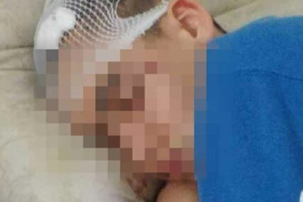 ŠOK U GRAČANICI Svađa zbog djevojke kulminirala BRUTALNOM TUČOM
