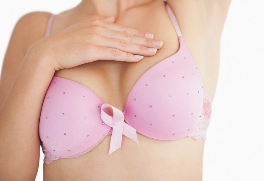 NAJNOVIJE ISTRAŽIVANJE Gel "tamoksifen" pomaže u prevenciji karcinoma dojke