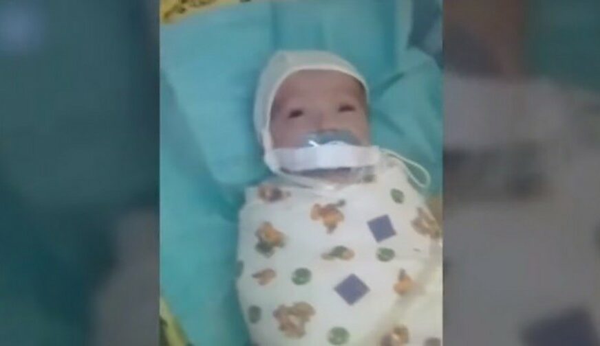OVO ĆE VAM SLOMITI SRCE Bebi u bolnici zalijepili cuclu na usta