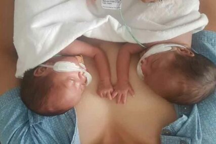 SVE SE TOPI Zagrljaj prijevremeno rođenih blizankinja objašnjava šta je PRAVA JUBAV (FOTO)