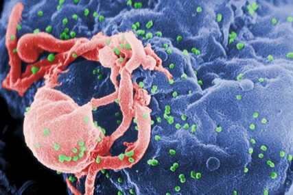 PACIJENT IZ LONDONA I druga osoba izliječena od virusa HIV