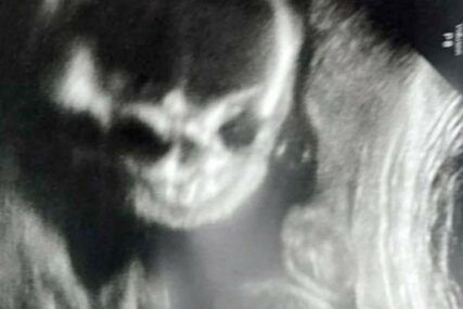 „POŽELJELA SAM DA SE NE PORODIM“ Buduću majku uplašila slika ultrazvuka bebe (FOTO)