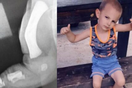 POMOZIMO MALOM AJNURU Dječaku iz Ilijaša hitno potrebno 25.000 evra za operaciju noge u Turskoj