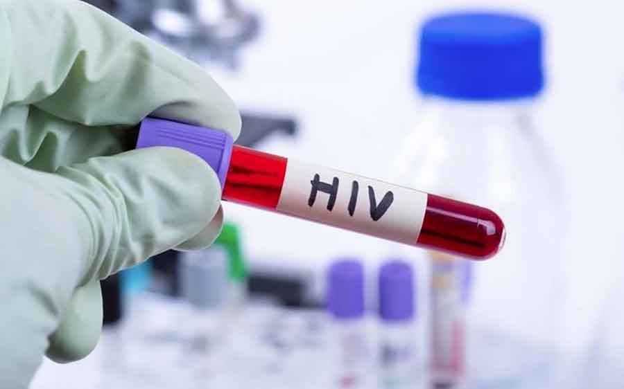 BOLEST ODNIJELA 56 ŽIVOTA Prošle godine HIV-om u Crnoj Gori zaraženo 23 ljudi