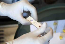 VELIKO OTKRIĆE RUSKIH NAUČNIKA Novi lijek smanjio broj HIV virusa 100.000 puta