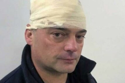 “ODGOVARAĆE I CRKVENI VELIKODOSTOJNICI” Crnogorski policajac pogođen kamenom u glavu