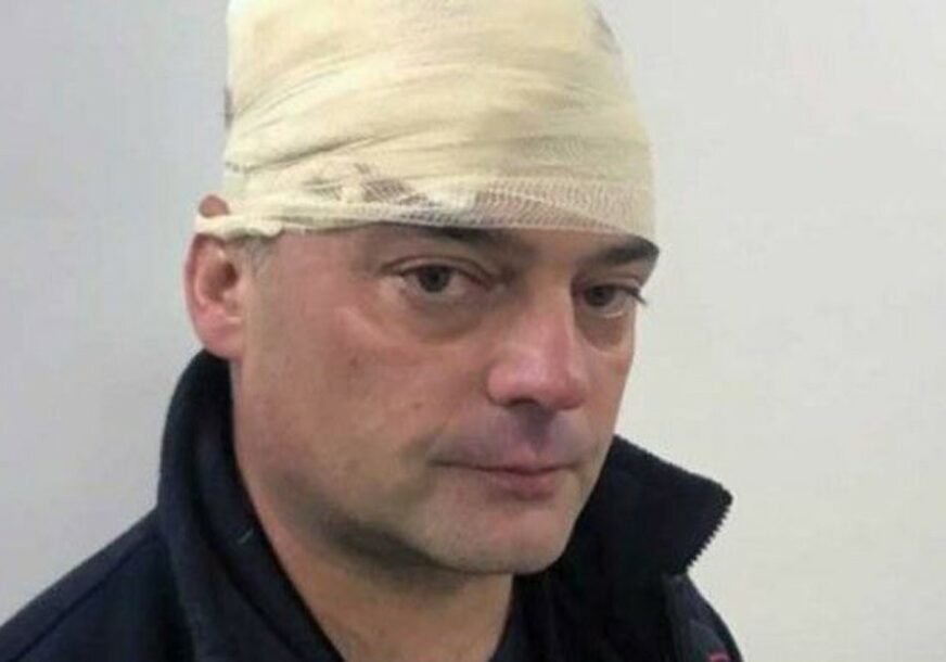 “ODGOVARAĆE I CRKVENI VELIKODOSTOJNICI” Crnogorski policajac pogođen kamenom u glavu
