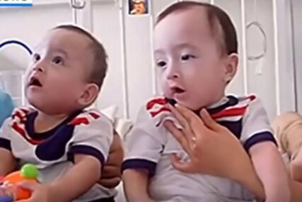 “TO JE BOŽIĆNO ČUDO” Sijamski blizanci iz Perua uspješno razdvojeni (VIDEO)