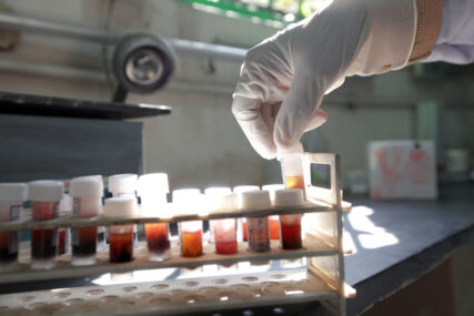 REVOLUCIONARNO Izumljen jednostavni test krvi koji detektuje sepsu u roku od 10 MINUTA