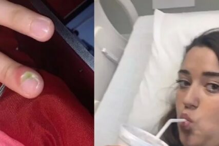 LOŠA NAVIKA Djevojka je godinama grickala nokte, zbog čega joj je umalo AMPUTIRAN PRST (VIDEO)