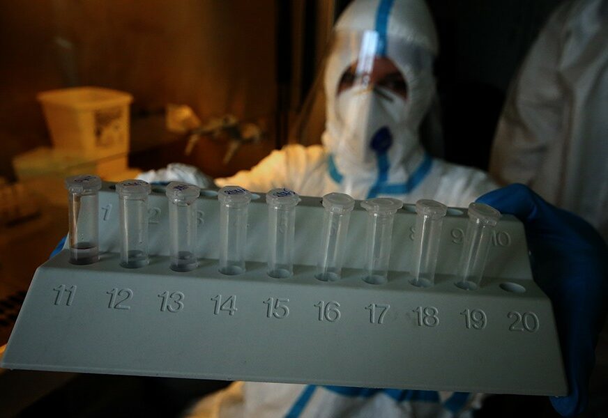 PREMINULE 23 OSOBE U Srbiji potvrđeno više od 1.000 novih slučajeva virusa korona