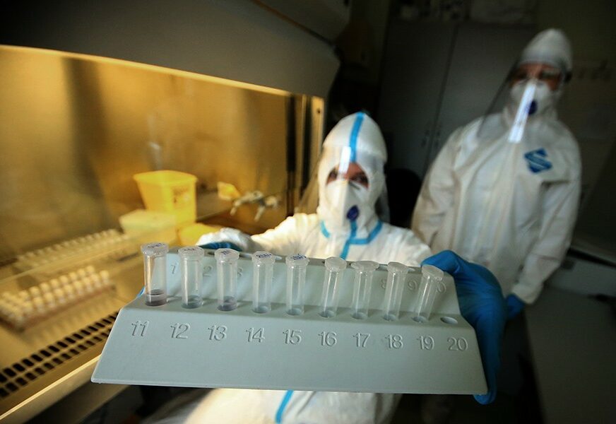 LIJEPE VIJESTI Negativni testovi srebreničkih medicinara na korona virus