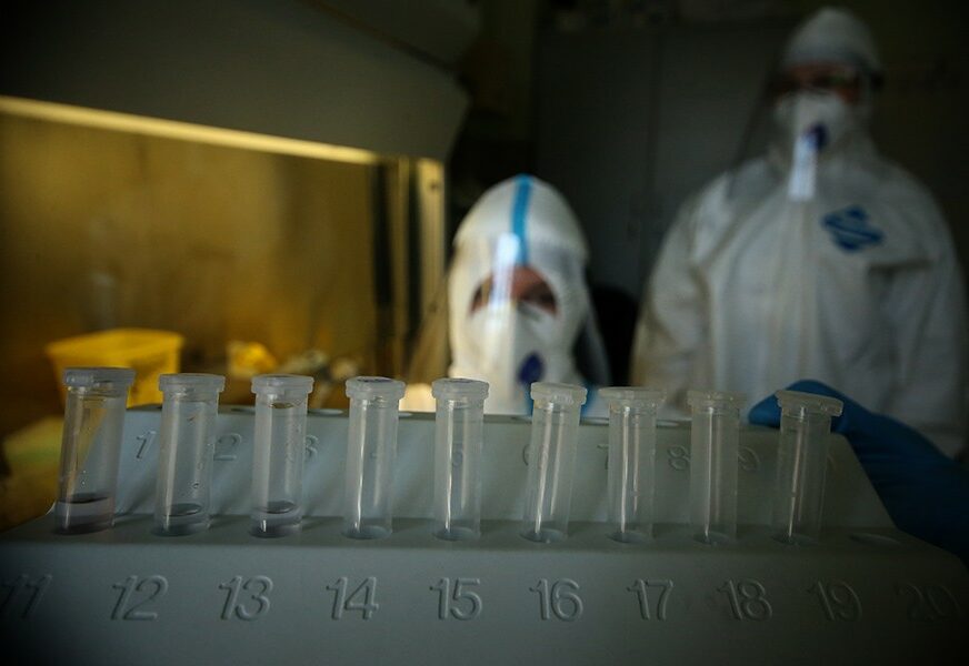 PREMINULO 57 PACIJENATA U Srbiji registrovano 7.818 novih slučajeva virusa korona