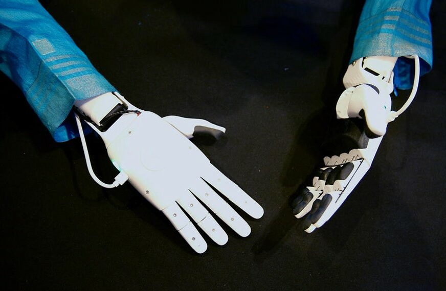 ZAMJENSKO OSOBLJE Roboti u italijanskoj bolnici spašavaju živote medicinara