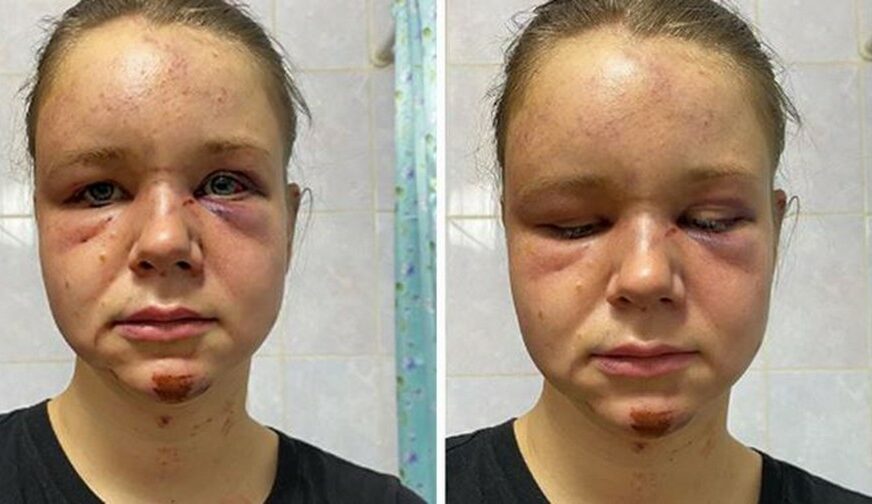 "BOLI DOK DIŠEM" Djevojčicu je fotka na Instagramu spasila da je porodica ne ubije