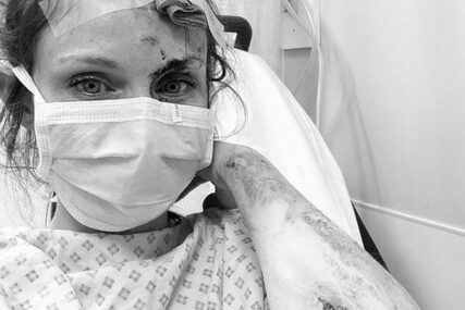 "HVALA MOMCIMA ZA POMOĆ" Pjevačica zadobila teške povrede pri padu sa bicikla (FOTO)