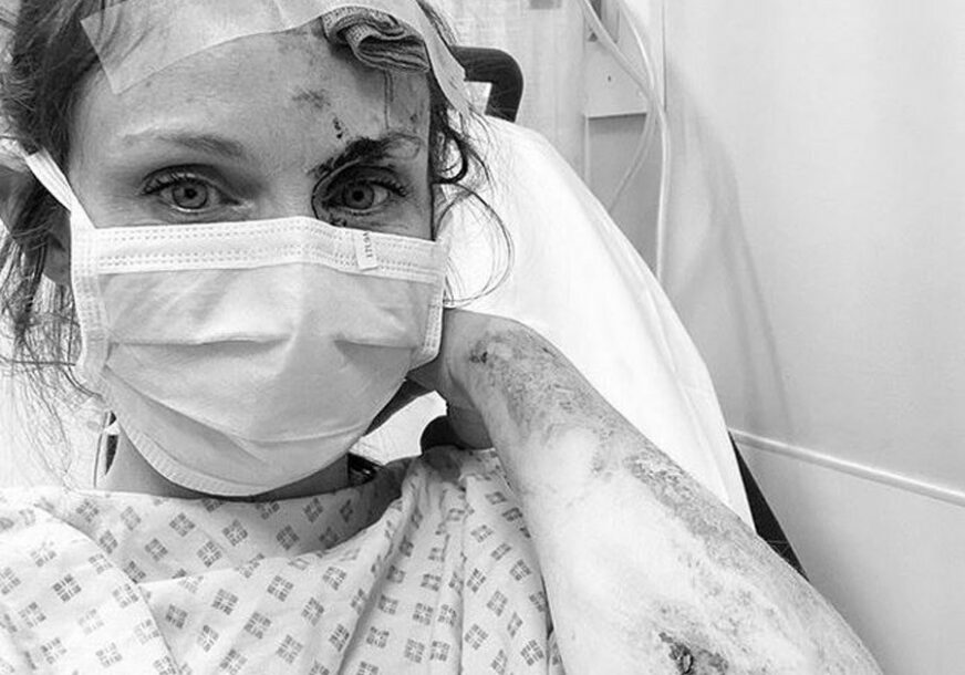 "HVALA MOMCIMA ZA POMOĆ" Pjevačica zadobila teške povrede pri padu sa bicikla (FOTO)