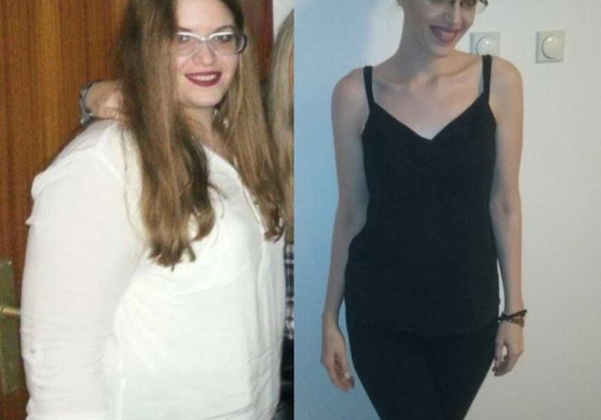 Aleksandra (27) je OVAKO smršala 50 kilograma, ali onda se desio PROBLEM