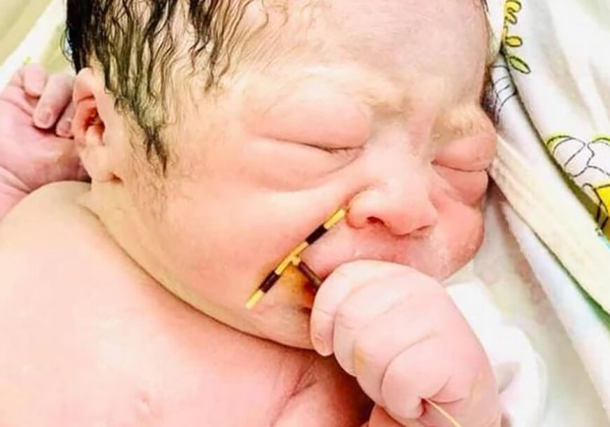 DJEČAK IZAZVAO BURU Fotografija bebe koja drži spiralu protiv začeća je ZA ISTORIJU