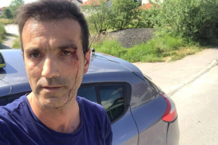 "UDARALI SU ME ŠAKAMA PO LICU" Brutalno napadnut taksista u Sarajevu