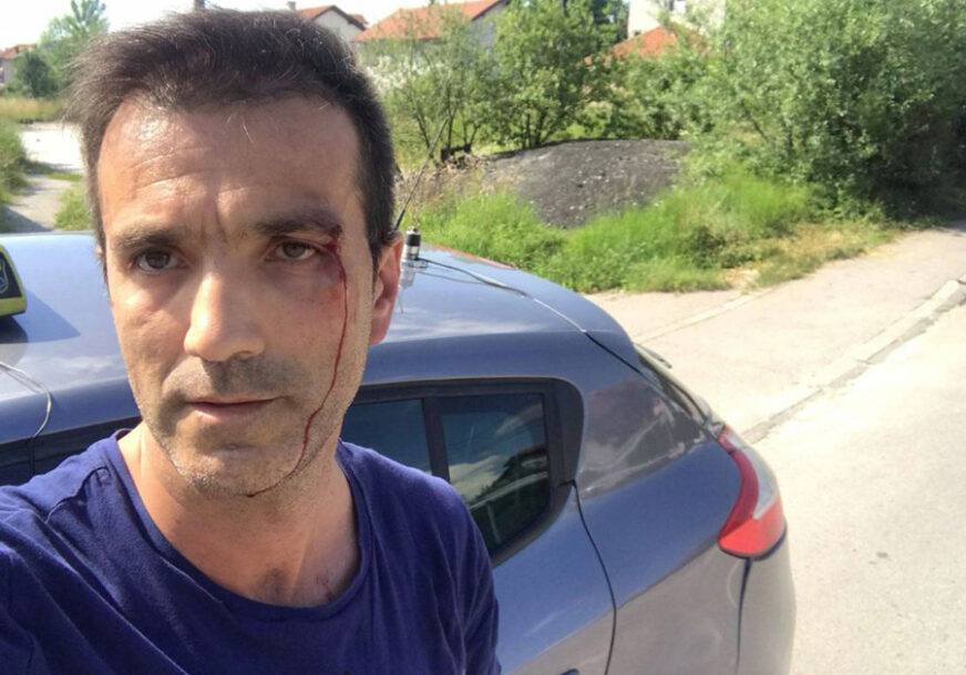 "UDARALI SU ME ŠAKAMA PO LICU" Brutalno napadnut taksista u Sarajevu