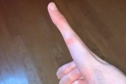 "DOKTOR KAŽE DA JE TO ABNORMALNO" Zbog onoga što radi sa palcem, ovog tinejdžera prati više od milion ljudi (VIDEO)