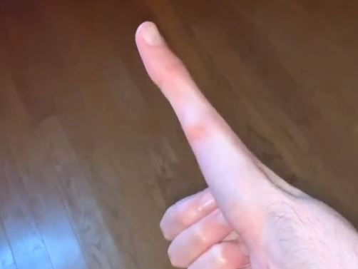 "DOKTOR KAŽE DA JE TO ABNORMALNO" Zbog onoga što radi sa palcem, ovog tinejdžera prati više od milion ljudi (VIDEO)