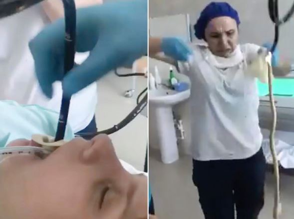 UZNEMIRUJUĆE Djevojka se požalila na strašne bolove, ljekari joj sondom kroz grlo izvukli ZMIJU (VIDEO)