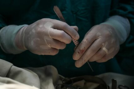 JEZIV SLUČAJ Vrhunski hirurg 25 godina gomilao dijelove tijela od 1.000 pacijenata