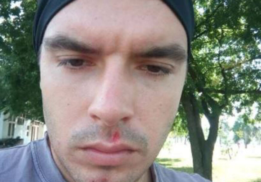 "SVAKO GLEDA SVOJA POSLA" Stefan je pao na ulici, a niko nije prišao da mu pomogne