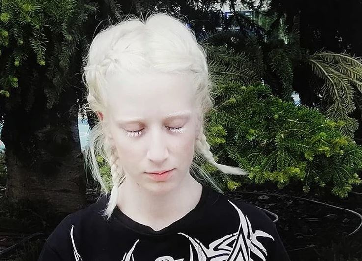 "GOVORILI SU MI DA SAM DUH ILI VAMPIR" Svetlana ima albinizam, slijepa je od rođenja, a sve prepreke savladava uspješno