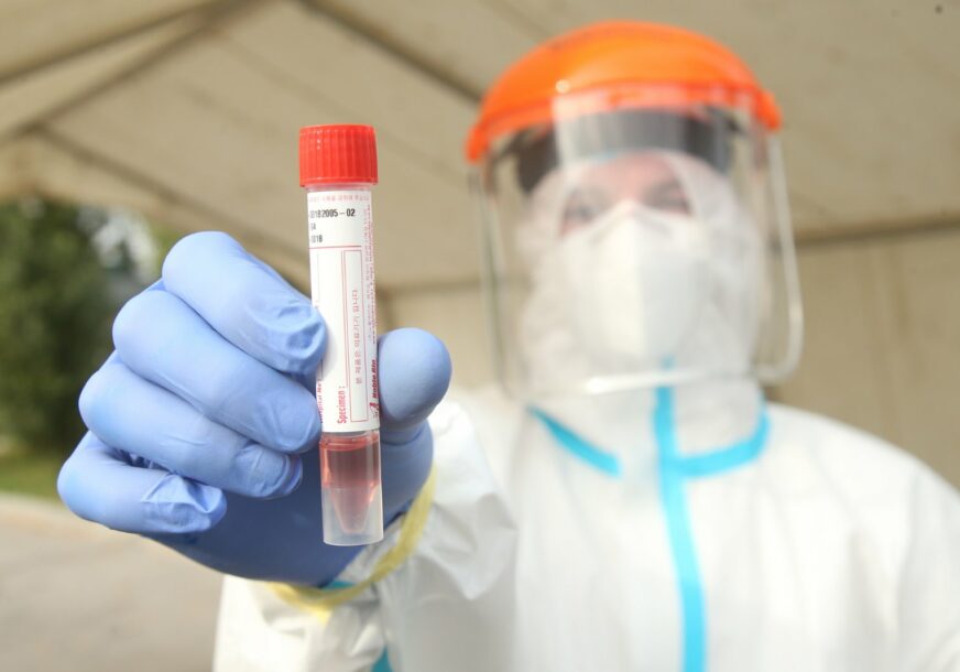 PREMINULE ČETIRI OSOBE Korona virusom zaraženo još 37 ljudi u Srpskoj