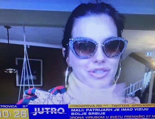 "MOJA PORODICA I JA SMO TO PREVAZIŠLI" Seka Aleksić imala korona virus, ovako je opisala simptome