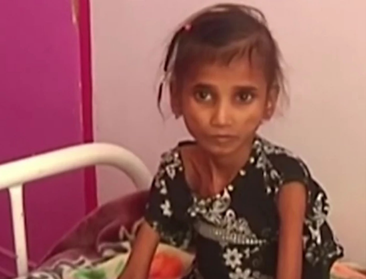 AKUTNO NEUHRANJENA Ima 13 godina i 11 kilograma i samo je jedna od dva miliona djece koji su navikli da budu gladni (VIDEO)