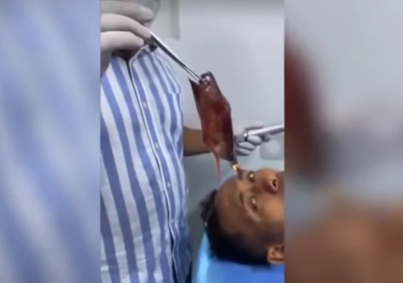 NESREĆA NA PECANJU Mladić se umalo ugušio nakon što mu je riba zapela u grlu (VIDEO)