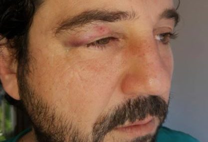 "Šokiran sam da me udario zbog lika u seriji" Ispred roštiljnice pretučen glumac Miljan Davidović