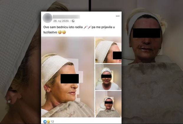 "Bjednica me prijavila" Nadriljekarka unakazila ženu iz Lukavca, a kada joj se požalila počela da je VRIJEĐA (FOTO)
