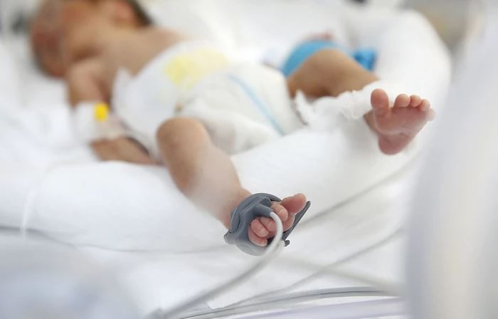 VELIKI PODVIG LJEKARA Novorođenčetu u toku porođaja otklonjen tumor, u suprotnom beba bi umrla po rođenju